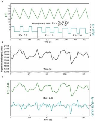 Physiological Mechanisms and Significance of Intracranial B Waves